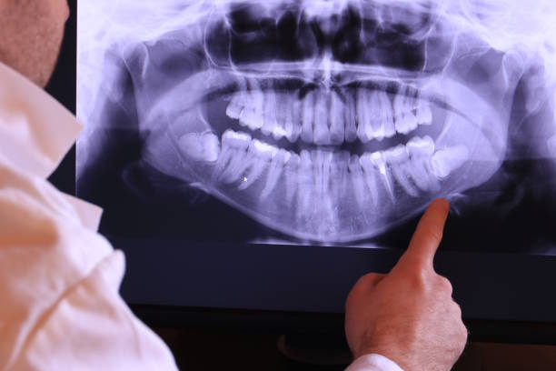 Best Emergency Dental Filling Replacement  in Laurel Hill, NC